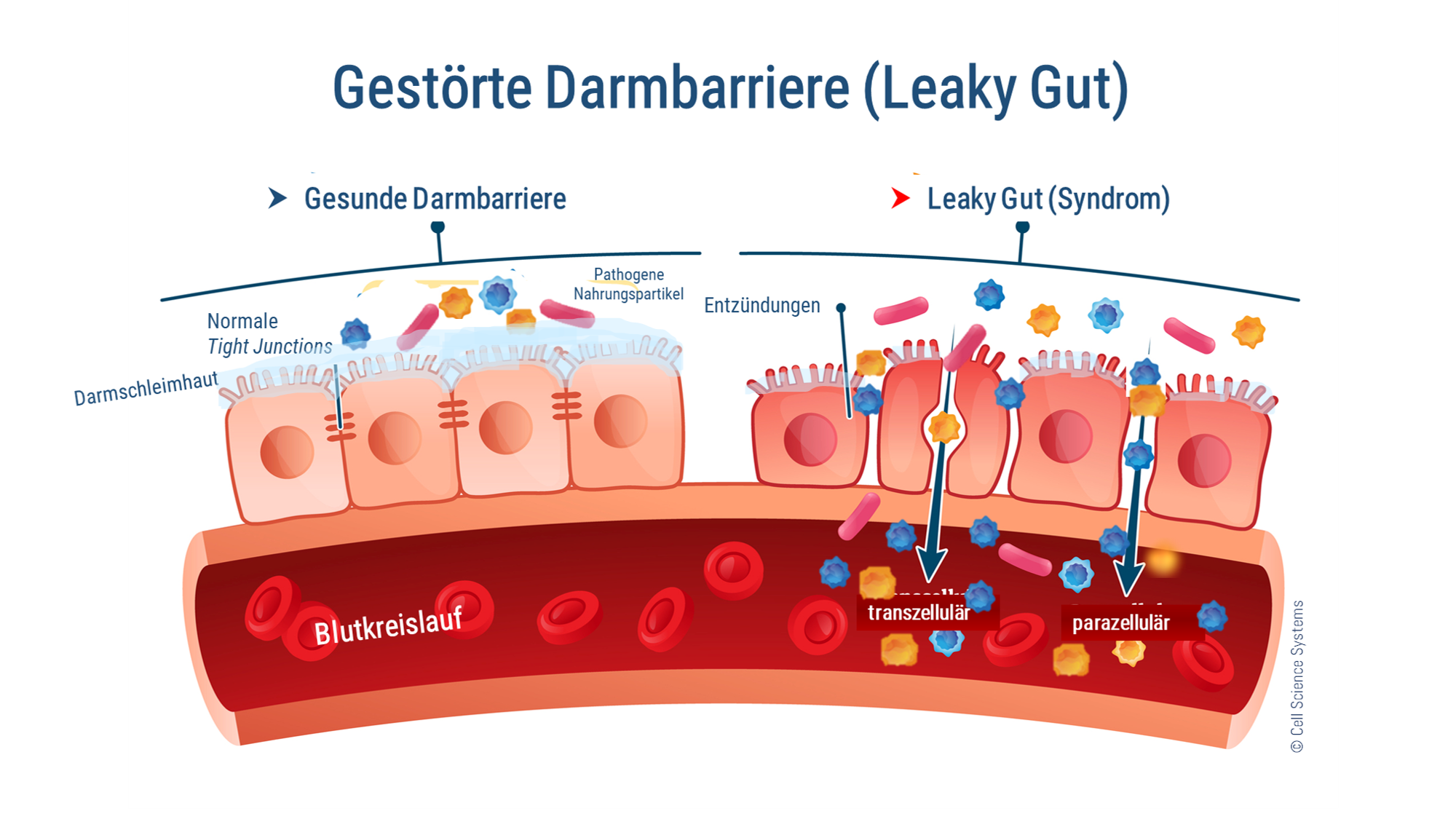 So entsteht Leaky Gut bzw. Leaky Gut Syndrom